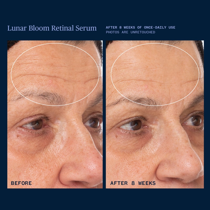 Ursa Major Lunar Bloom Retinal Serum - Before and after photo