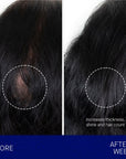 Augustinus Bader The Scalp Treatment showing before and after 12 weeks of use