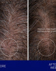 Augustinus Bader The Scalp Treatment showing before and after of 12 week use