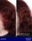 Augustinus Bader The Shampoo showing before and after 12 weeks of use 