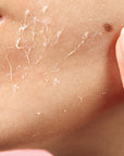 Close-up of a woman's peeling face of dead skin with use of Odacite Bioactive Rose Gommage