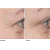Close up of area around eye showing baseline and 2 weeks use results of Le Prunier Plum Beauty Oil