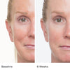 Showing baseline and 6 weeks use results of Le Prunier Plum Beauty Oil on woman