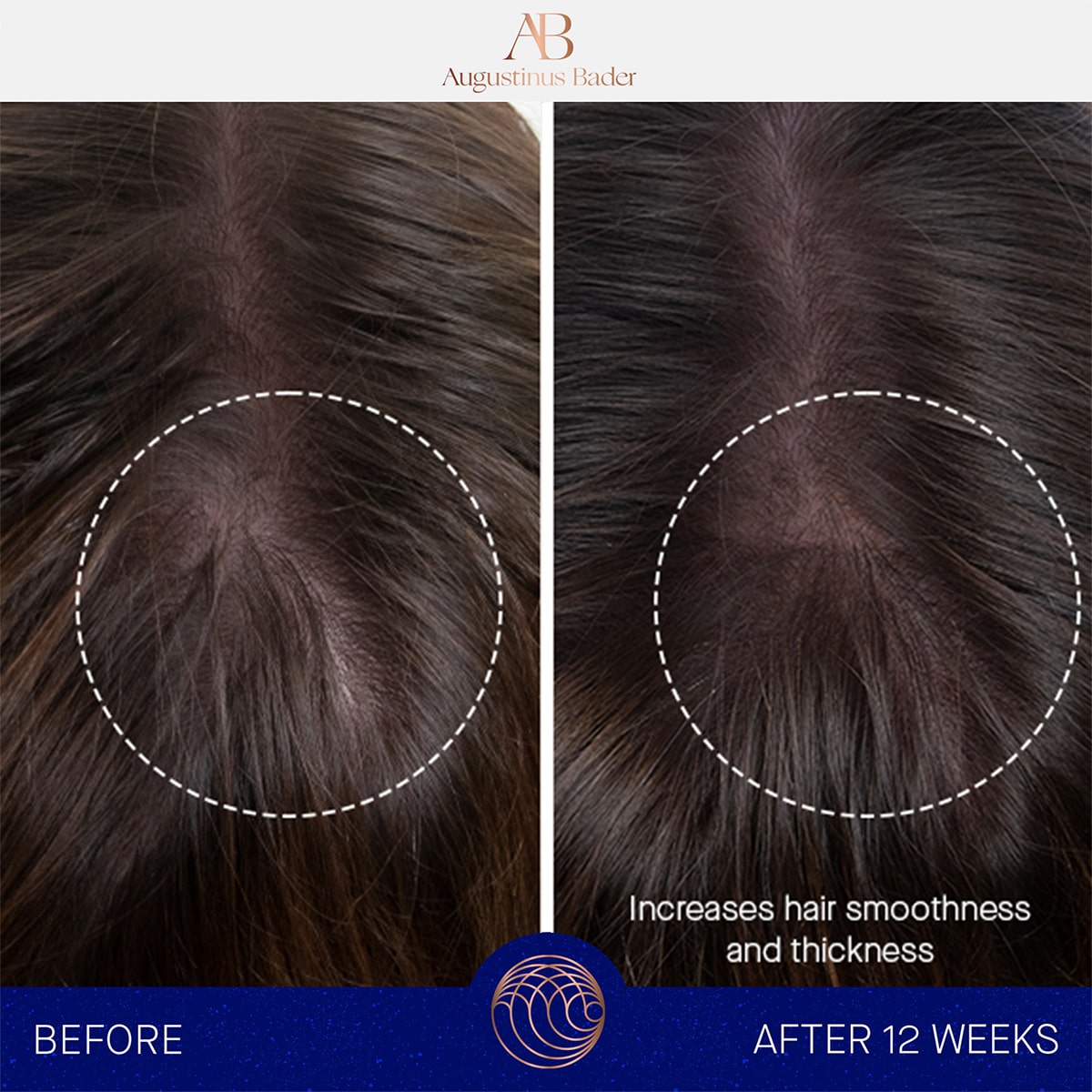 Augustinus Bader The Hair Oil (30 ml) - before and after product usage shown on model