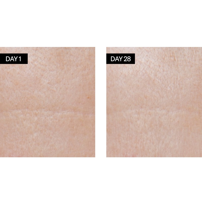 Close up of skin on Day 1 and Day 28 with use of Odacite Retinol + Hyaluronic Acid Renewing Serum