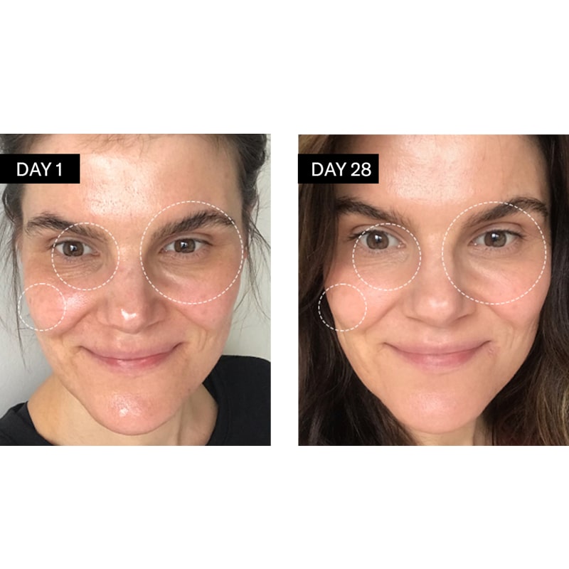 Close up of face on Day 1 and Day 28 with use of Odacite Vitamin C &amp; E + Hyaluronic Acid Brightening Serum (specifically showing improvement under eyes and cheek bone)