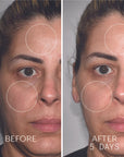 Before and after use on female model with use of Yon-Ka Paris Vitamin C Serum C20 (5 days)