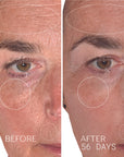 Before and after shown on male model with use of Yon-Ka Paris Vitamin C Serum C20 (56 days)