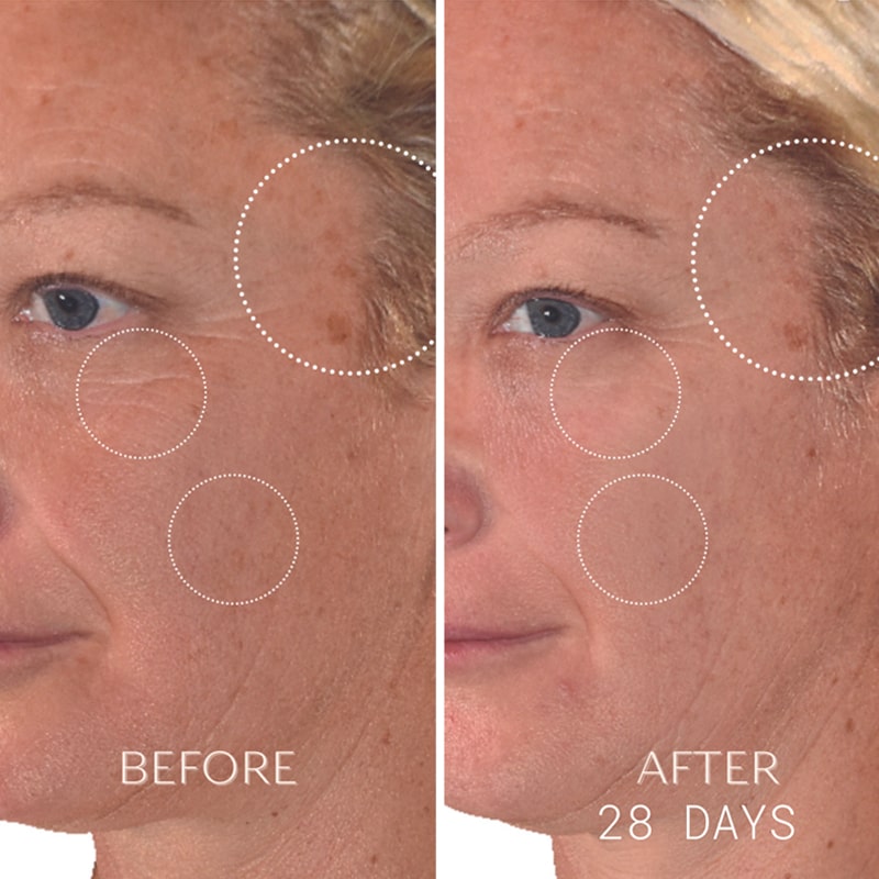 Before and after model use on female model of Yon-Ka Paris Vitamin C Serum C20 (28 days)