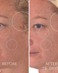 Before and after model use on female model of Yon-Ka Paris Vitamin C Serum C20 (28 days)