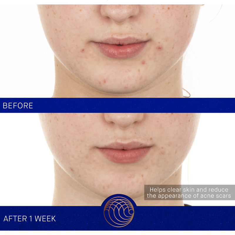 Augustinus Bader The Retinol Serum (15 ml) - Before and after photos female model