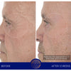 Augustinus Bader The Retinol Serum (15 ml) - Before and after photos male model