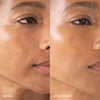 Furtuna Skin Triple Active Exfoliator - Before and after photos