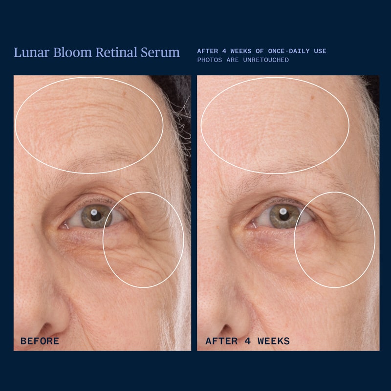 Ursa Major Lunar Bloom Retinal Serum - Before and after photo