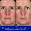 Augustinus Bader The Hydrogel Face Mask Pack - before and after product usage shown
