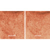 Close up of Before and After use of Chantecaille Blanc Peony Face Serum Dark Spot Corrector