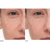 Le Prunier Plumtox Clarifying Enzyme Mask - model shown before and after product usage 