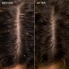 Scalp shown before and after use of Roz SALT Scalp Scrub