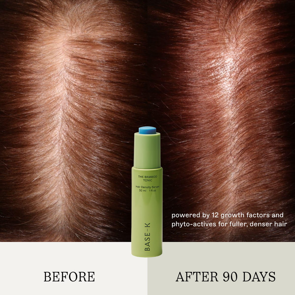 BASE-K The Bamboo Tonic Hair Density Serum (30 ml) centered against a split before-and-after background showing hair growth results on brown hair. Text reads 'BEFORE' and 'AFTER 90 DAYS' with descriptive copy "powered by 12 growth factors and phyto-actives for fuller, denser hair."
