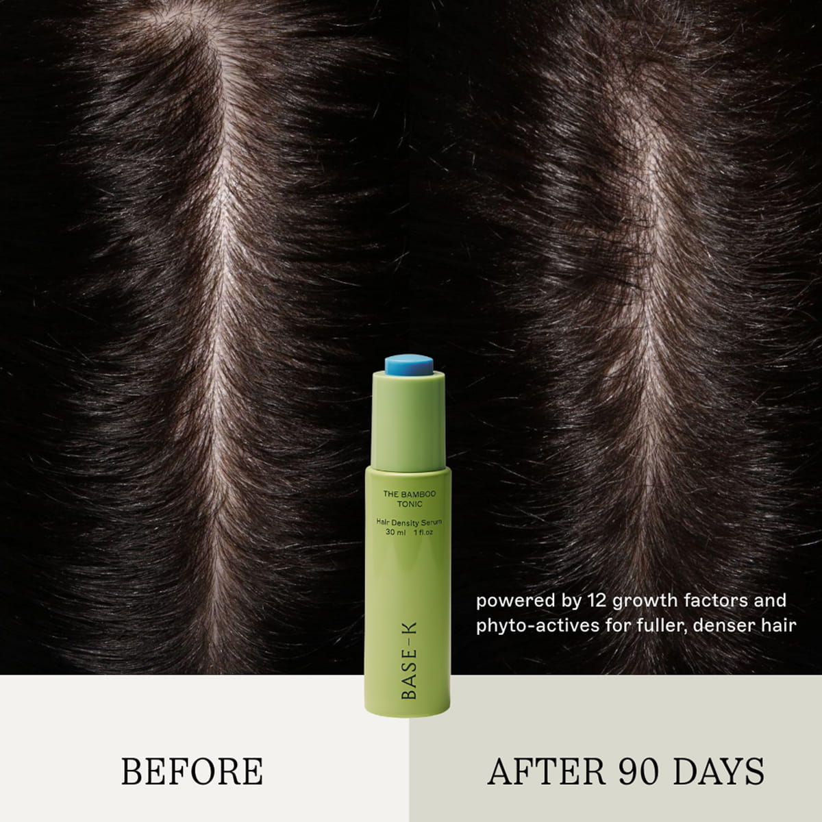 BASE-K The Bamboo Tonic Hair Density Serum (30 ml) centered against a split before-and-after background showing hair growth results on black hair. Text reads 'BEFORE' and 'AFTER 90 DAYS' with descriptive copy "powered by 12 growth factors and phyto-actives for fuller, denser hair."