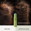 BASE-K The Bamboo Tonic Hair Density Serum (30 ml) centered against a split before-and-after background showing hair growth results on man's hair. Text reads 'BEFORE' and 'AFTER 90 DAYS' with descriptive copy "powered by 12 growth factors and phyto-actives for fuller, denser hair."