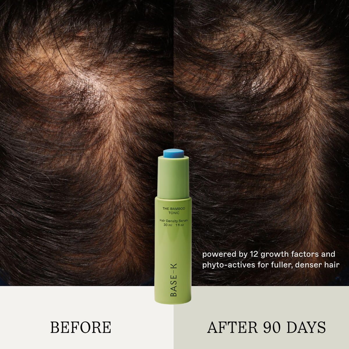 BASE-K The Bamboo Tonic Hair Density Serum (30 ml) centered against a split before-and-after background showing hair growth results on man's hair. Text reads 'BEFORE' and 'AFTER 90 DAYS' with descriptive copy "powered by 12 growth factors and phyto-actives for fuller, denser hair."