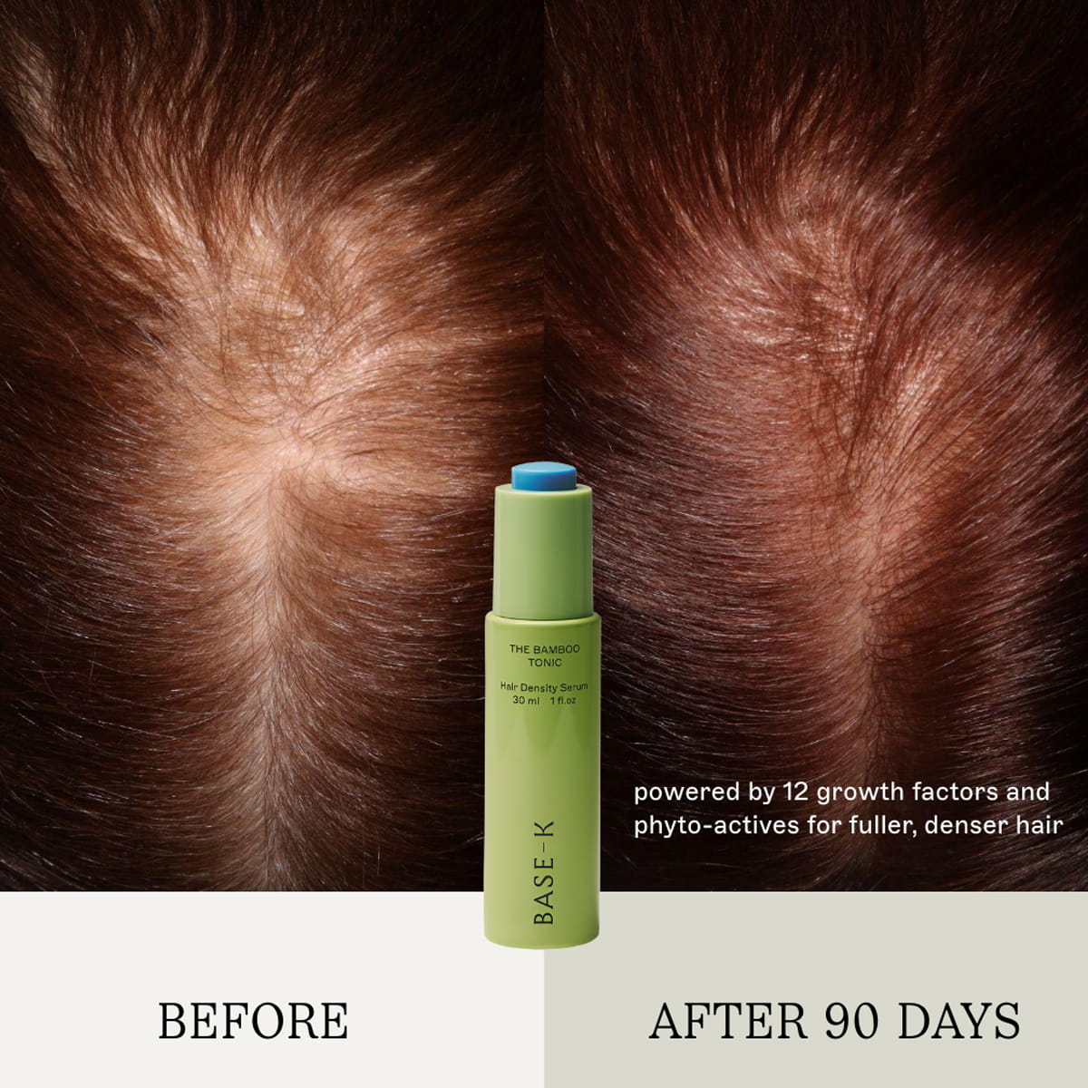 BASE-K The Bamboo Tonic Hair Density Serum (30 ml) centered against a split before-and-after background showing hair growth results on red hair. Text reads 'BEFORE' and 'AFTER 90 DAYS' with descriptive copy "powered by 12 growth factors and phyto-actives for fuller, denser hair."