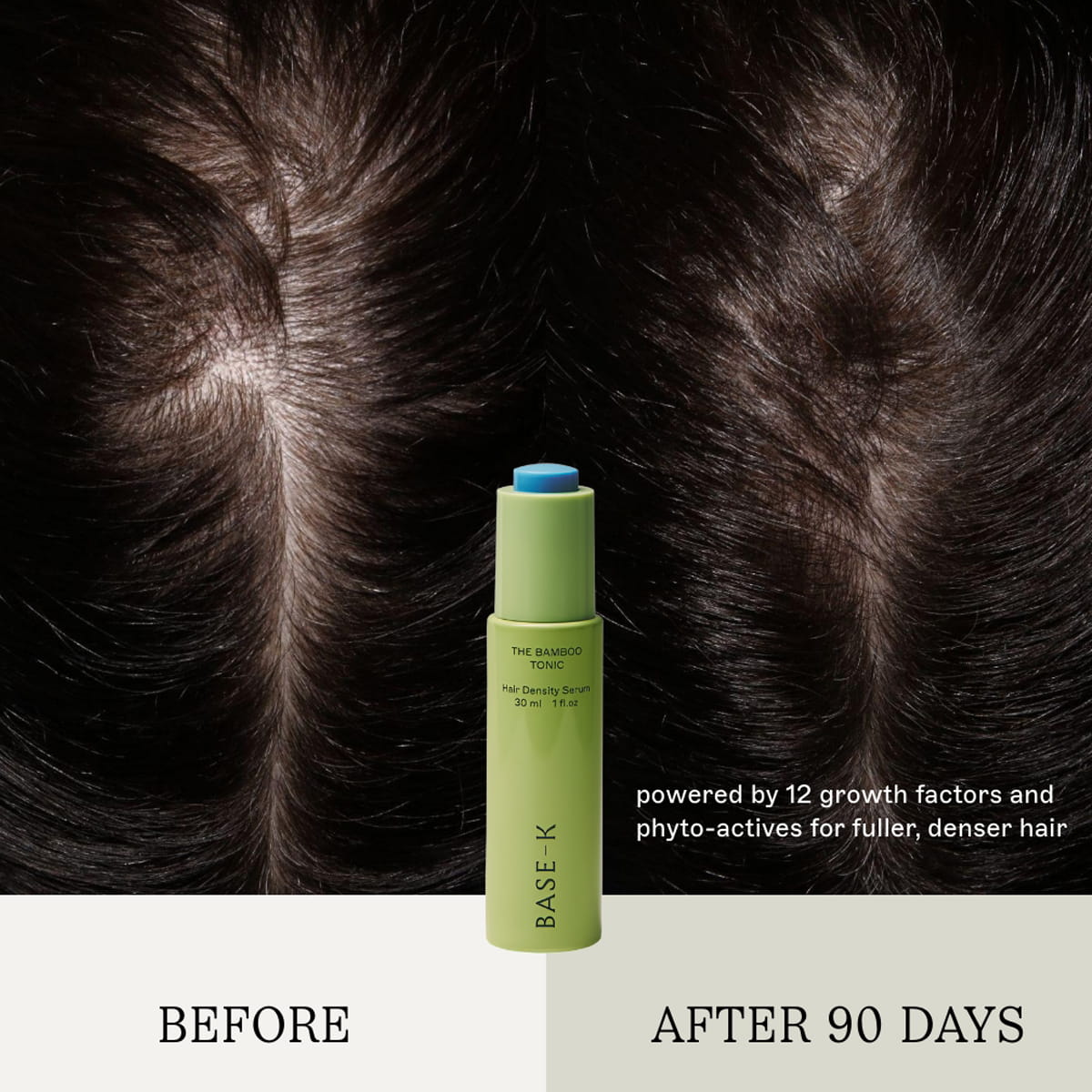 BASE-K The Bamboo Tonic Hair Density Serum (30 ml) centered against a split before-and-after background showing hair growth results on black hair. Text reads 'BEFORE' and 'AFTER 90 DAYS' with descriptive copy "powered by 12 growth factors and phyto-actives for fuller, denser hair."
