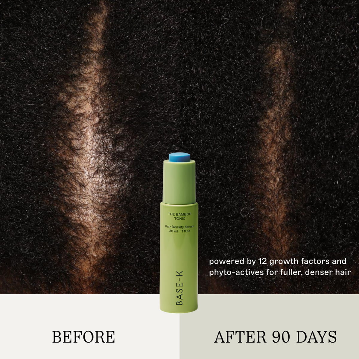 BASE-K The Bamboo Tonic Hair Density Serum (30 ml) centered against a split before-and-after background showing hair growth results on tight/curly hair. Text reads 'BEFORE' and 'AFTER 90 DAYS' with descriptive copy "powered by 12 growth factors and phyto-actives for fuller, denser hair."