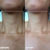 Wrinkles Schminkles Neck Wrinkle Patch (1 pc)  - product before and afters shown. 