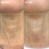 Wrinkles Schminkles Neck Wrinkle Patch (1 pc)  - product before and afters shown. 