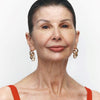 Wrinkles Schminkles Mouth & Lip Wrinkle Patch (1 pc) - product shown on model. 