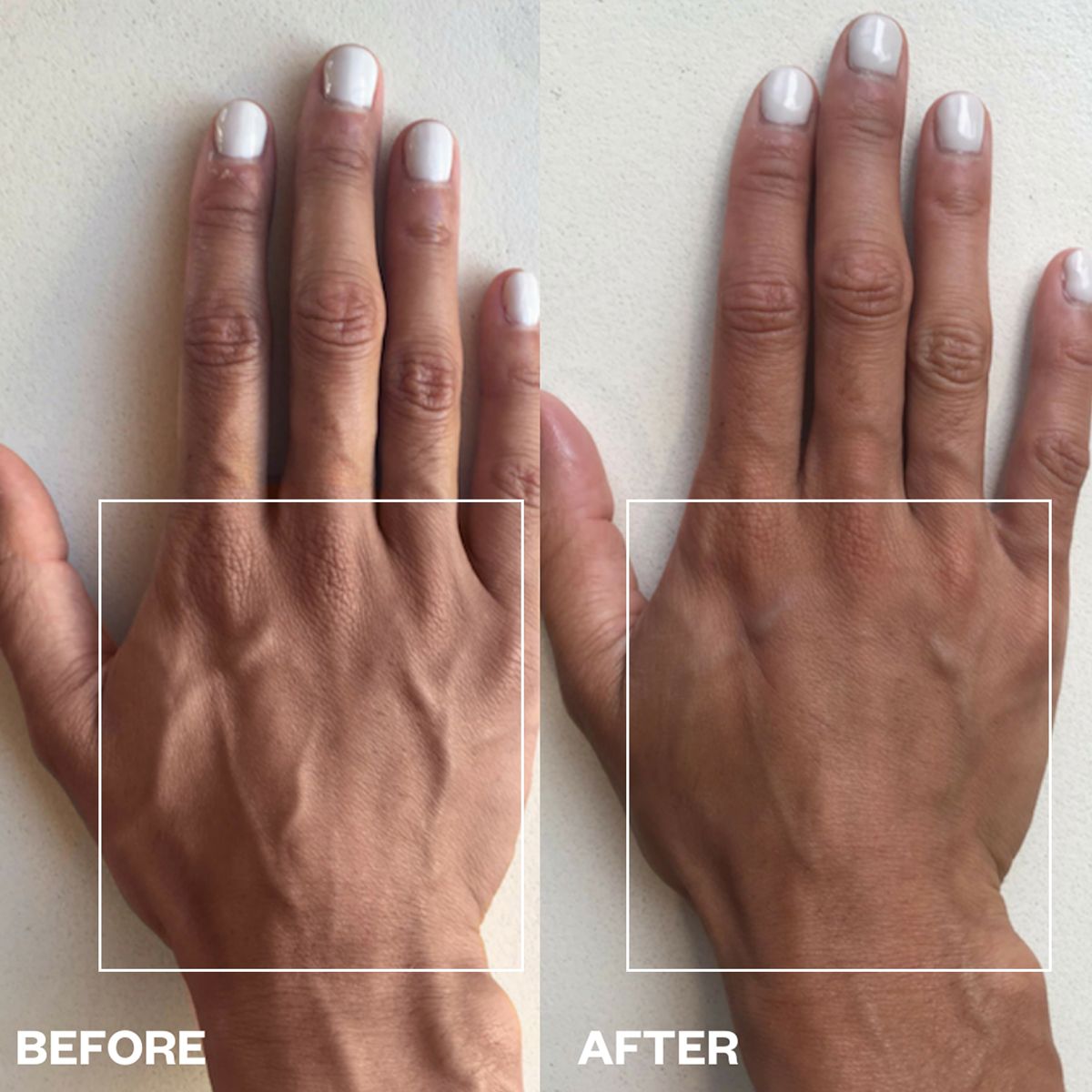 Wrinkles Schminkles Hand Wrinkle Patches (2 pcs) - product before and afters shown.