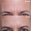 Wrinkles Schminkles Forehead Wrinkle Patches (2 pcs) - product before and afters shown. 