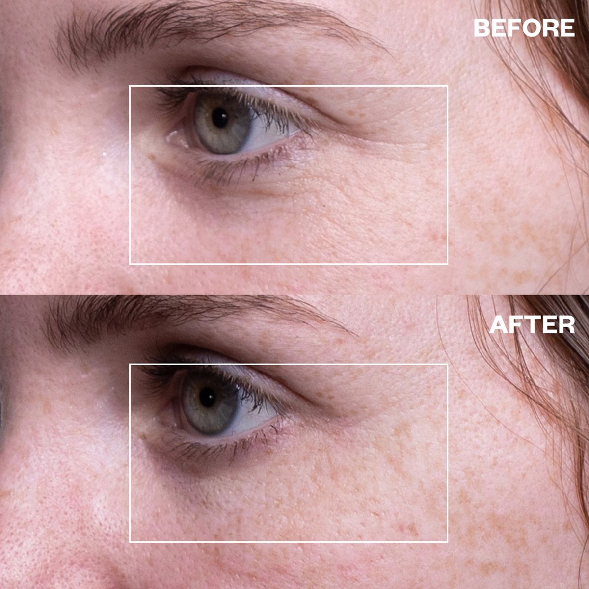 Wrinkles Schminkles Eye Wrinkle Patches (6 pcs) - product before and afters shown.