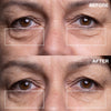 Wrinkles Schminkles Eye Wrinkle Patches (6 pcs) - product before and afters shown.
