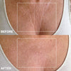 Wrinkles Schminkles Chest Wrinkle Patch (1 pc) - product before and afters shown. 