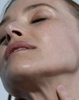 Close up of Model's face with Odacite Aloe Immortelle Hydra-Repair Treatment Mist applied