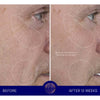Augustinus Bader The Serum showing before and after