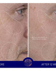 Augustinus Bader The Serum showing before and after
