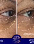 Before and after shot of model using Lifestyle shot of Augustinus Bader The Eye Cream after 12 weeks