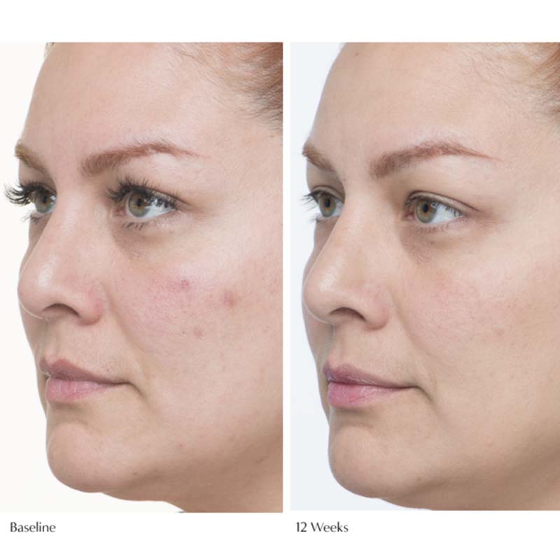 Le Prunier Plumscreen SPF 31 showing a before and after 