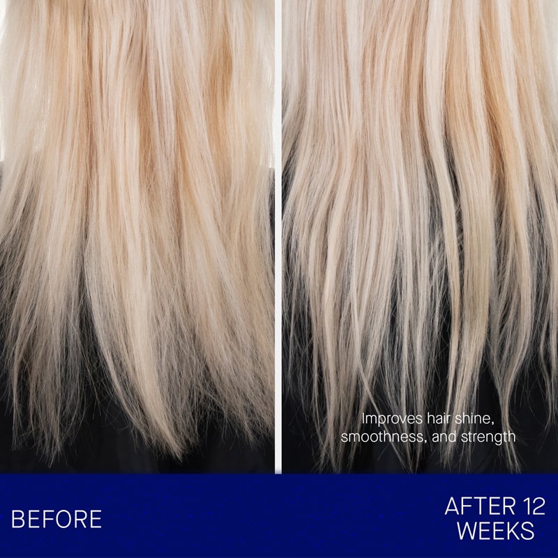 Augustinus Bader The Leave In Hair Treatment showing a before and after 12 weeks of use