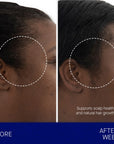 Augustinus Bader The Scalp Treatment showing before and after