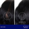 Augustinus Bader The Scalp Treatment showing before and after 12 weeks of use
