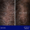 Augustinus Bader The Scalp Treatment showing before and after of 12 week use