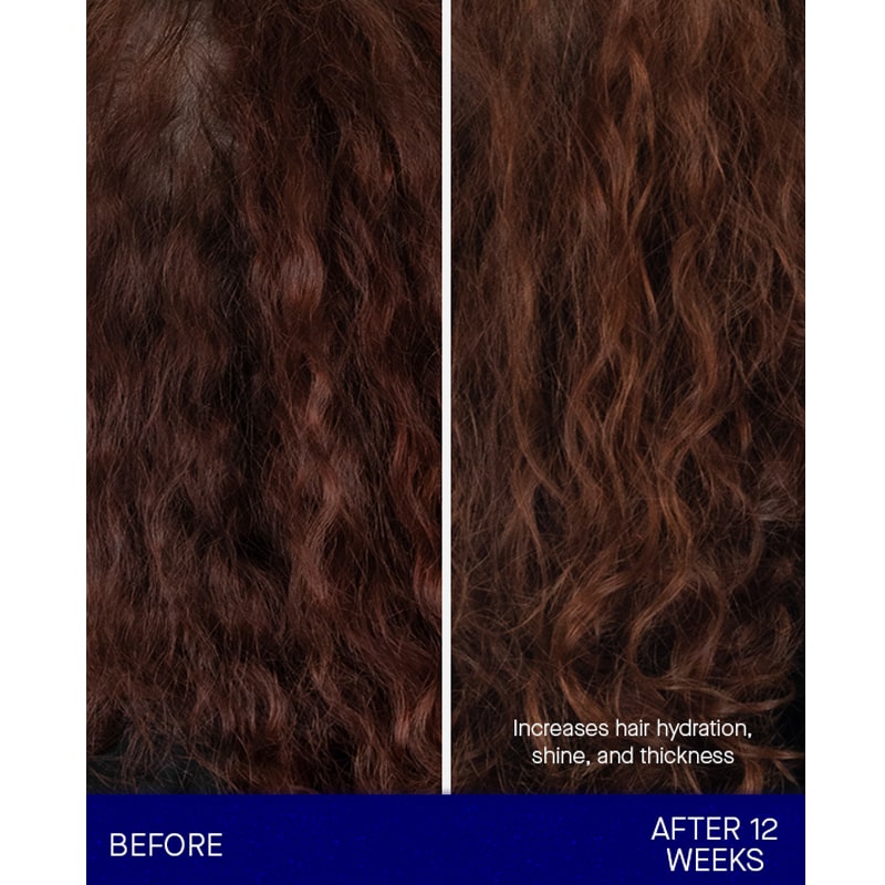 Augustinus Bader The Shampoo showing before and after 12 weeks of use