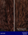 Augustinus Bader The Shampoo showing before and after 12 weeks of use