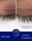 Augustinus Bader The Eyebrow and Lash Enhancing Serum showing before and after 12 weeks change in eye lashes