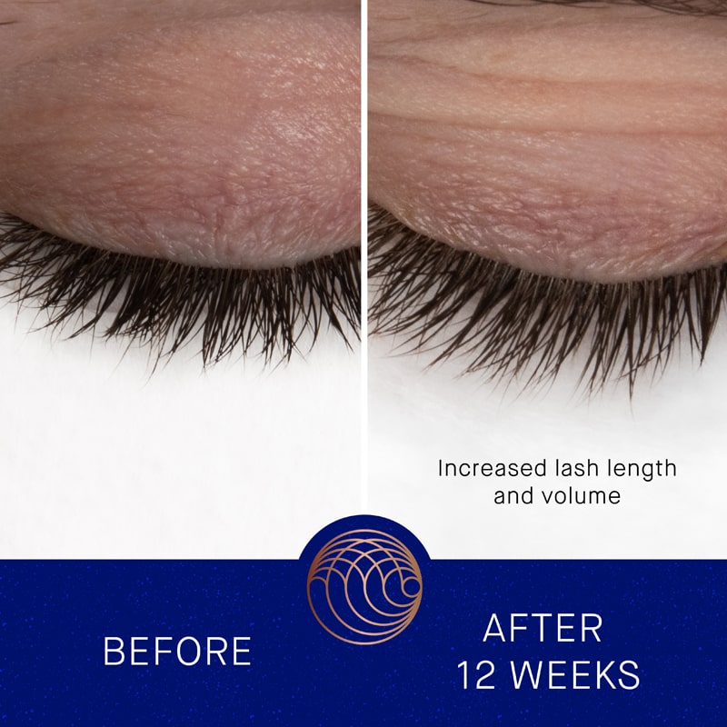 Augustinus Bader The Eyebrow and Lash Enhancing Serum showing another model before and after 12 weeks of use on lashes